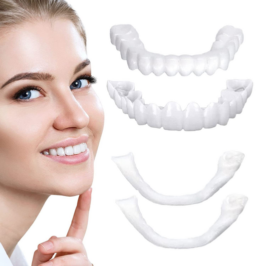 Montura Carillas dentales postizas